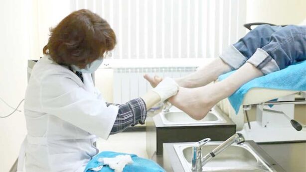 Dermatolog liječi gljivice noktiju na nogama